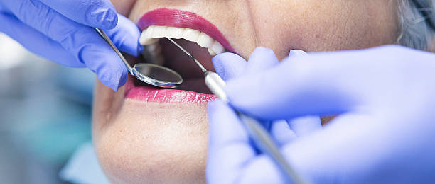 Best Emergency Cosmetic Dentistry (e.g., broken veneers) in Livingston, AL